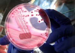 E coli Outbreak in Northern France